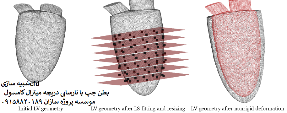 شبیه سازی cfd بطن چپ با نارسایی دریچه میترال کامسول
